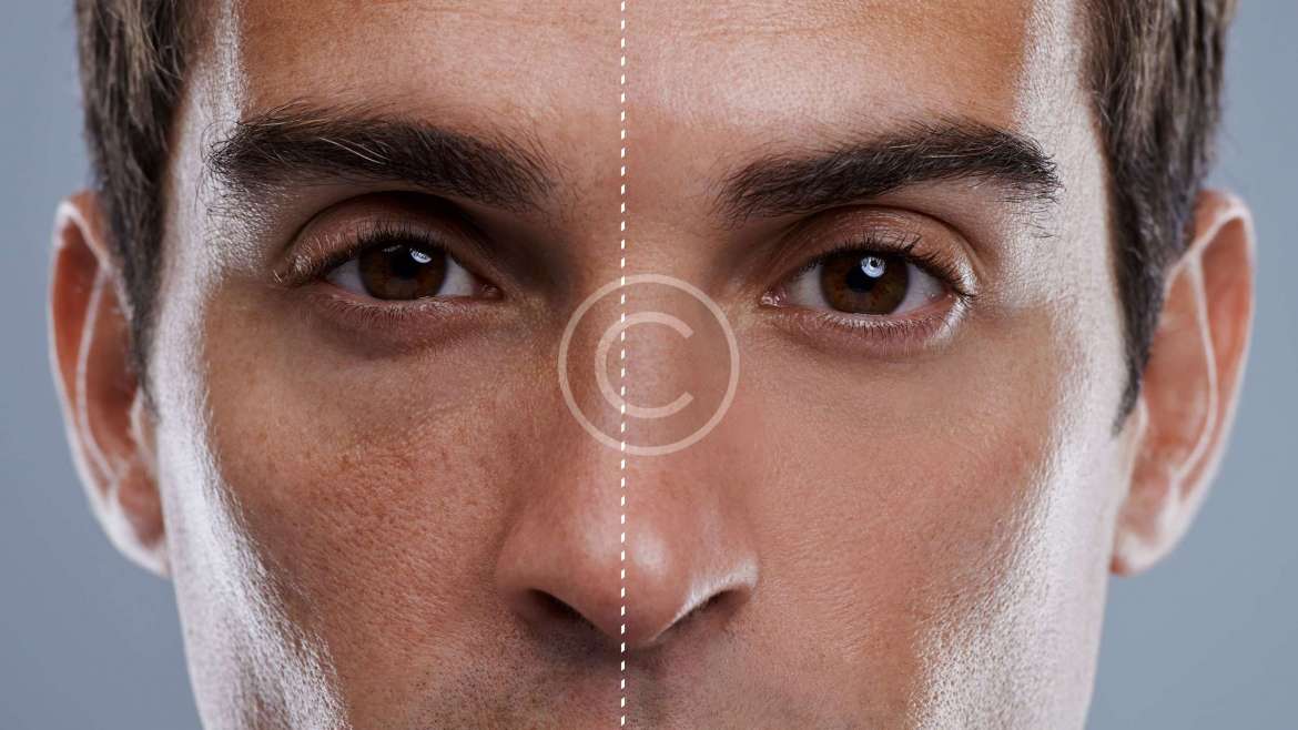 Silhouette et Minceur